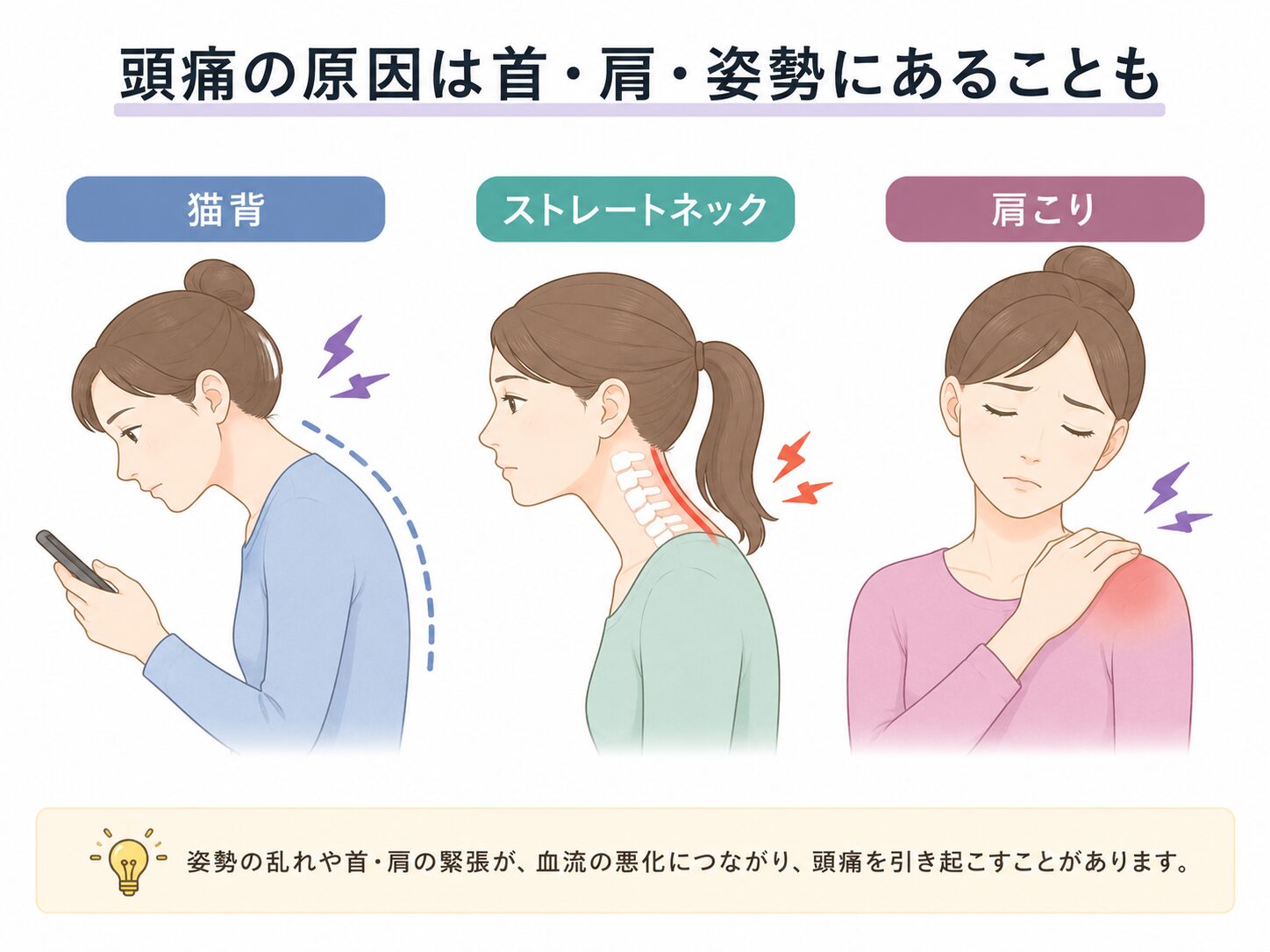 姿勢不良と頭痛の関係イメージ|石山