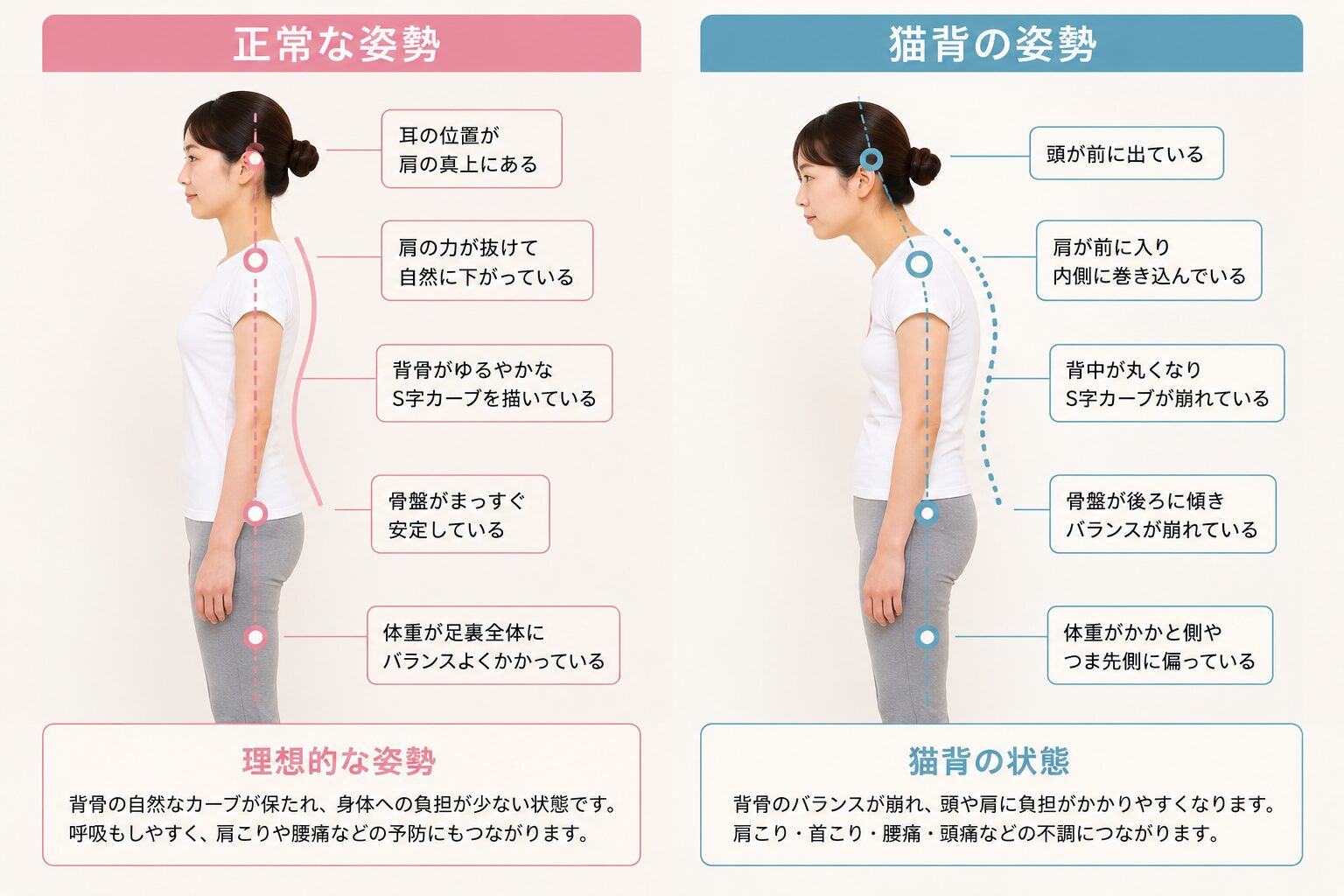 猫背と正しい姿勢の比較